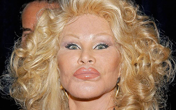 Звезды, потратившие целое состояние на пластику